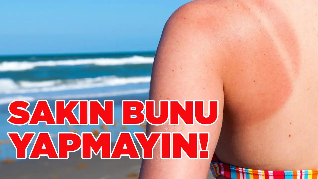 Herkes bu yöntemi uyguluyor ama… Güneş yanığında sakın bunları yapmayın!