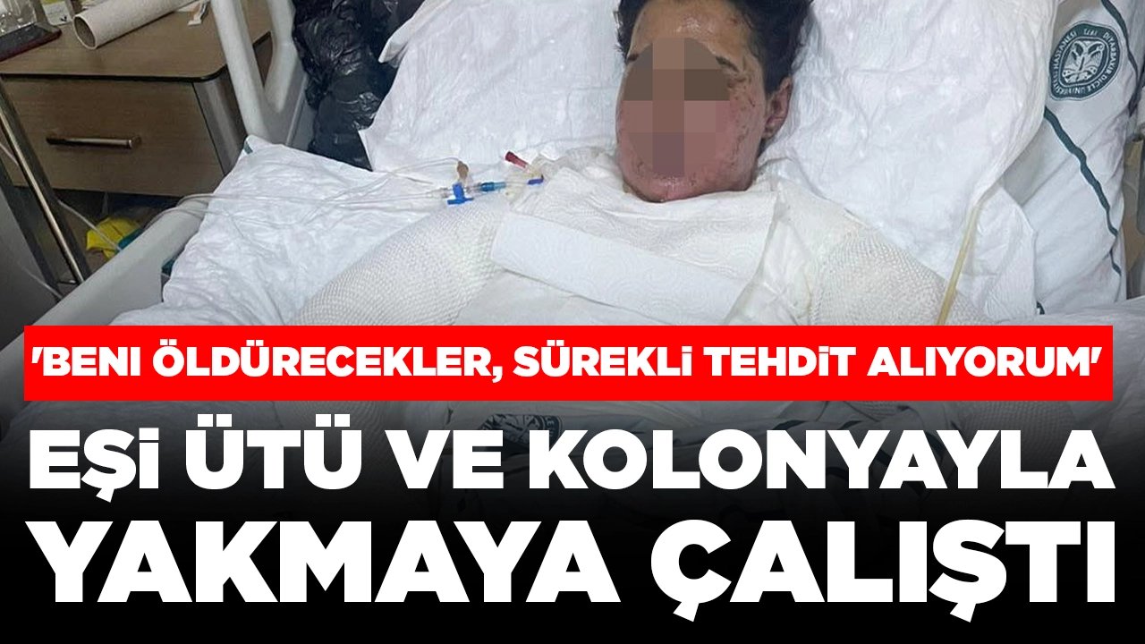 Eşi ütü ve kolonyayla yakmaya çalıştı: 'Beni öldürecekler, sürekli tehdit alıyorum'