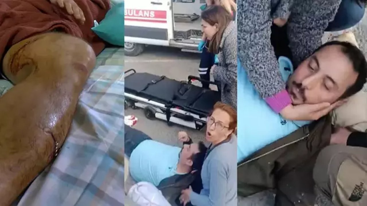 Beylikdüzü Sahili'nde pitbull saldırısı!