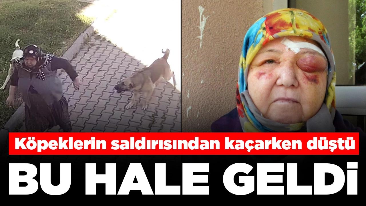 Başıboş köpeklerin saldırısından kaçarken düştü: Bu hale geldi