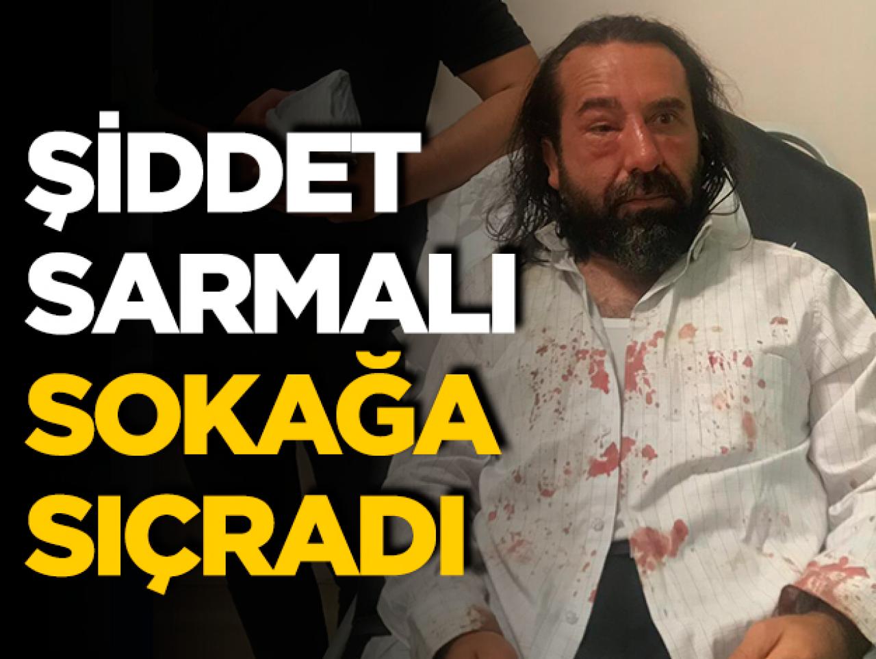 Şiddet sarmalı sokağa sıçradı!