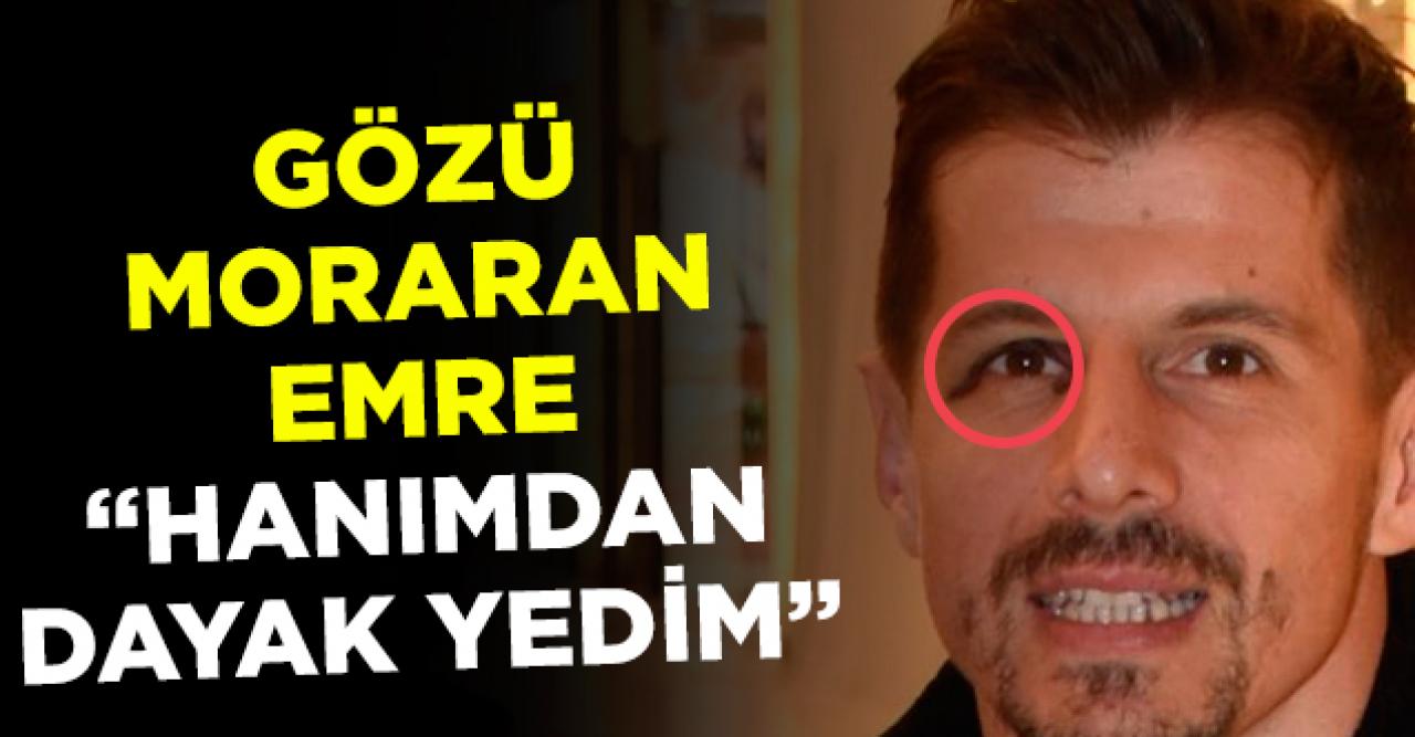 Emre Belözoğlu: Hanımdan dayak yedim