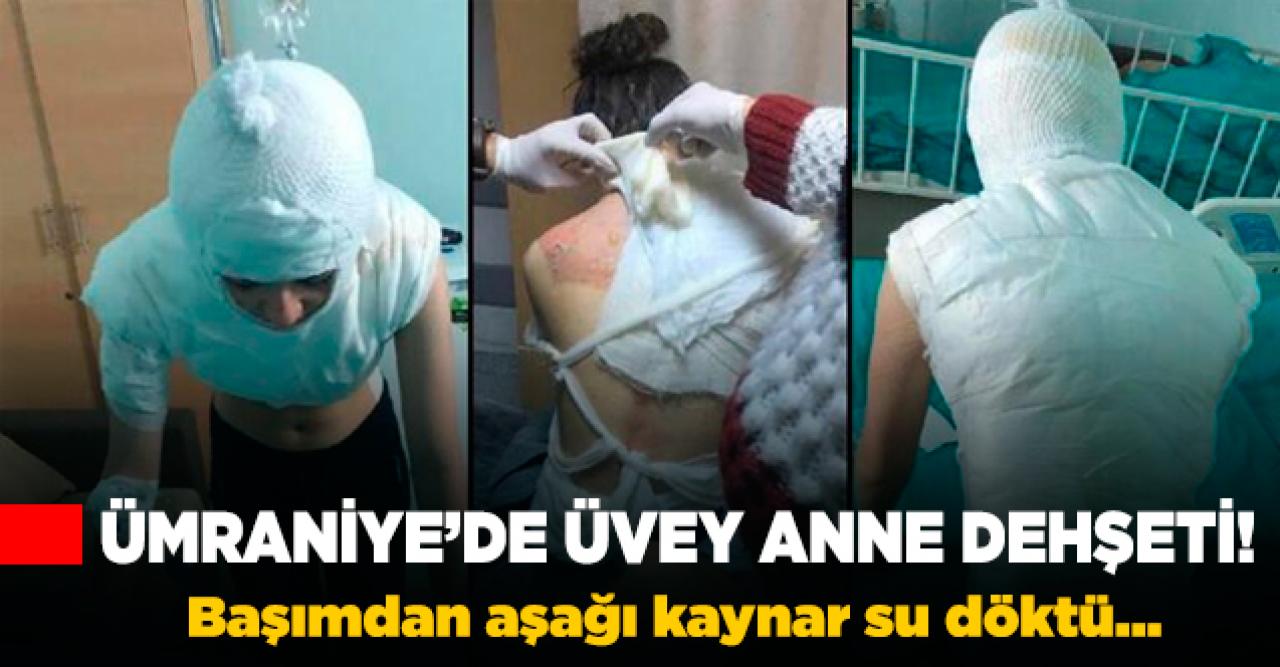 Üvey annesi dehşet yaşattı!