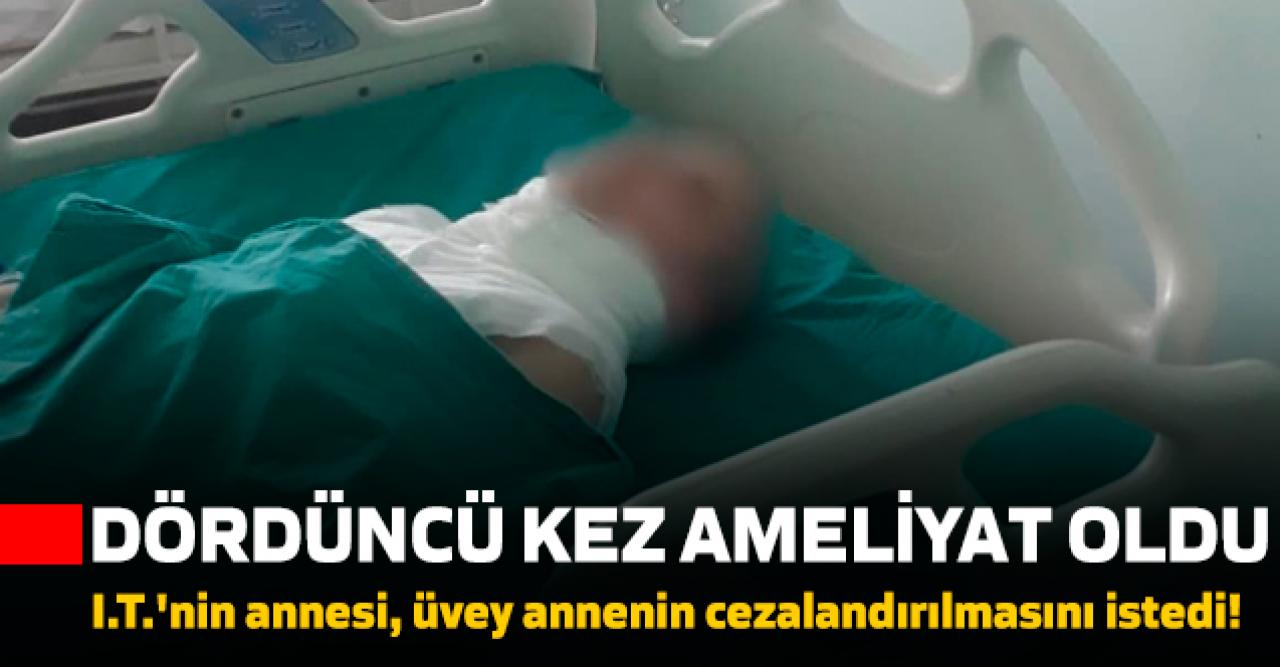 Üvey annesi tarafından yakıldığı öne sürülen kız 4. kez ameliyat oldu!