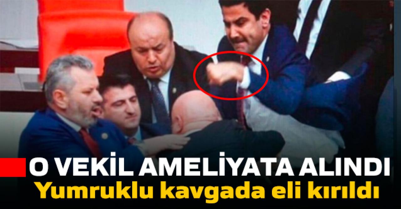 Özkoç'a yumruk atarken eli kırılan vekil ameliyata alındı