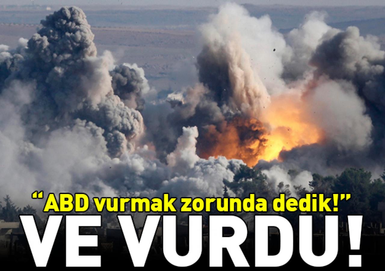 ABD vurmak zorunda dedik! Ve vurdu