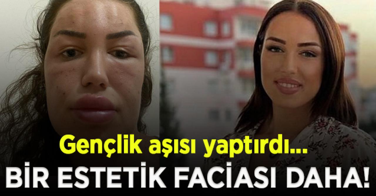 Estetik facialarına bir yenisi daha eklendi!  Gençlik aşısı yaptırmak isteyen kadın tanınmaz halde