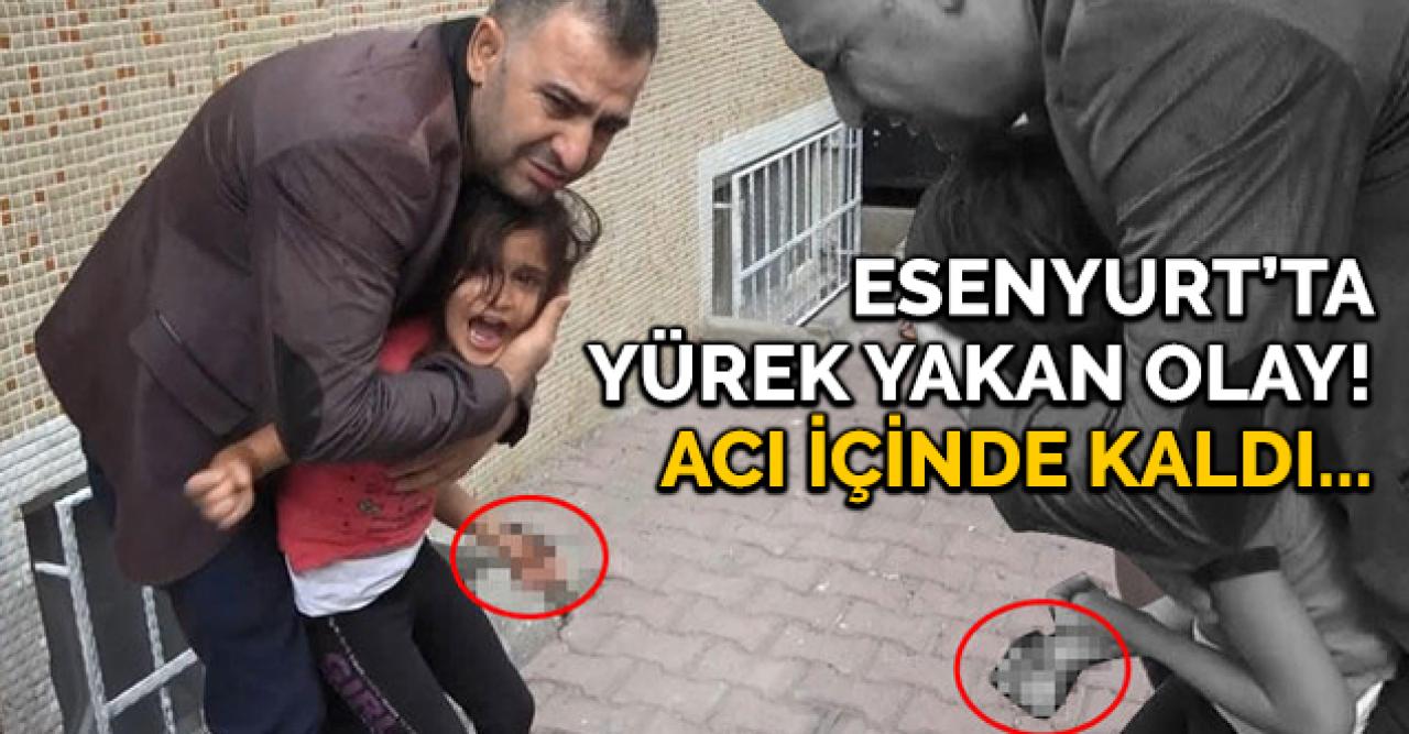 Esenyurt'ta acı olay! Demir kapı parmaklıkları bileğine saplandı