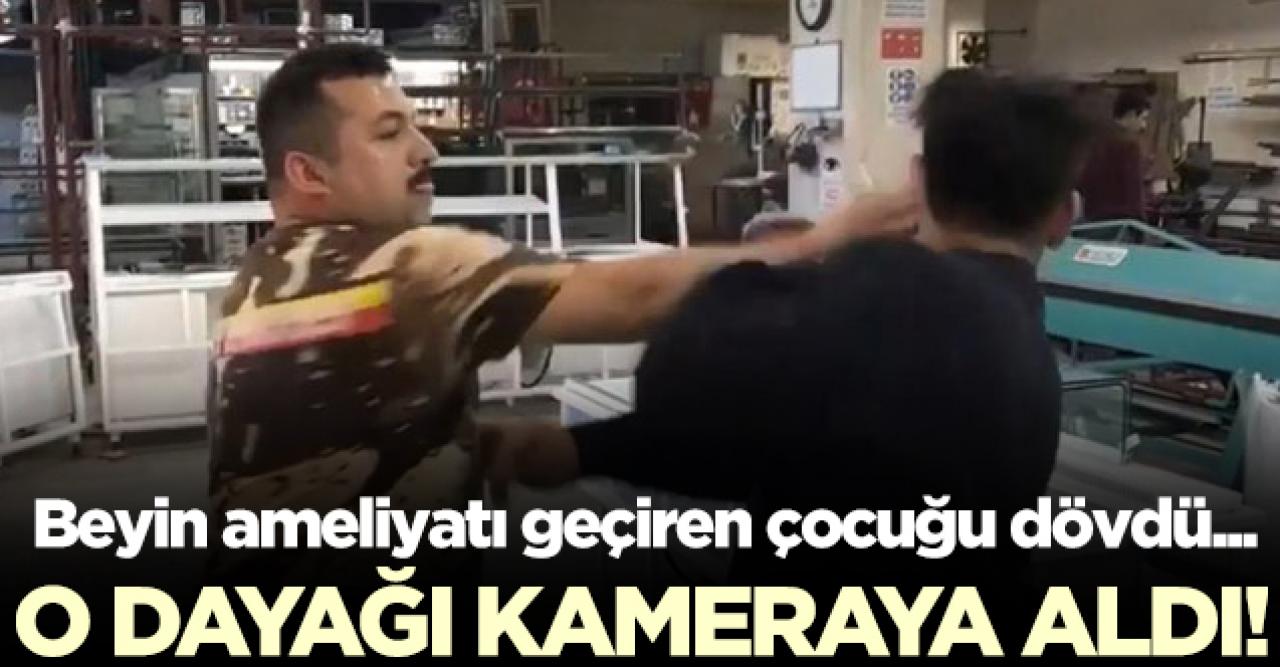 Beyin ameliyatı geçirmiş çocuğa dayak ve işkence iddiası