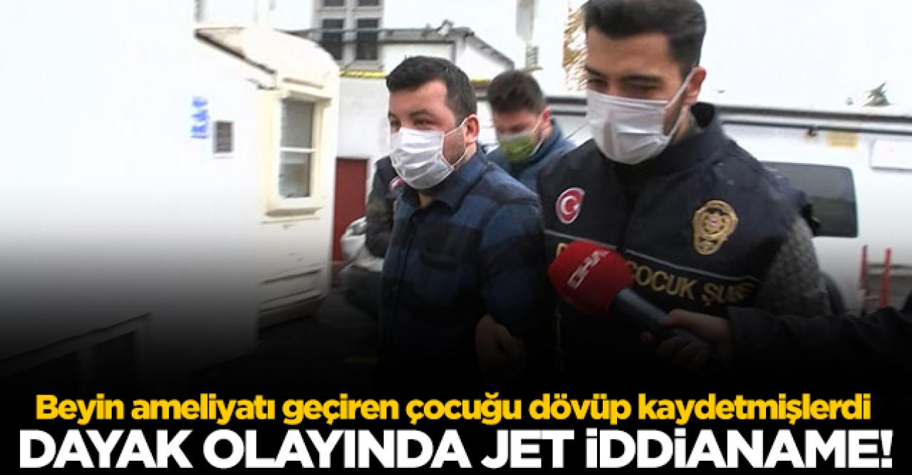 Çocuğa dayak olayında jet iddianame