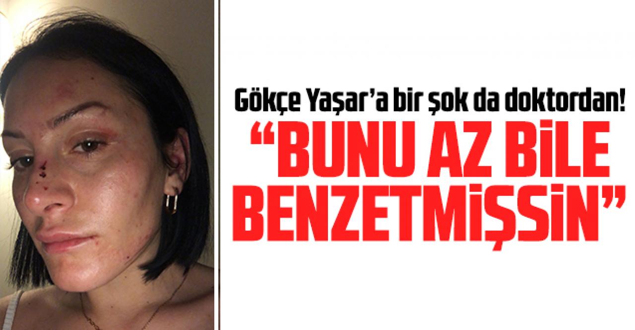 Gökçe Yaşar: Doktor 'Bunu az bile benzetmişsin' dedi!