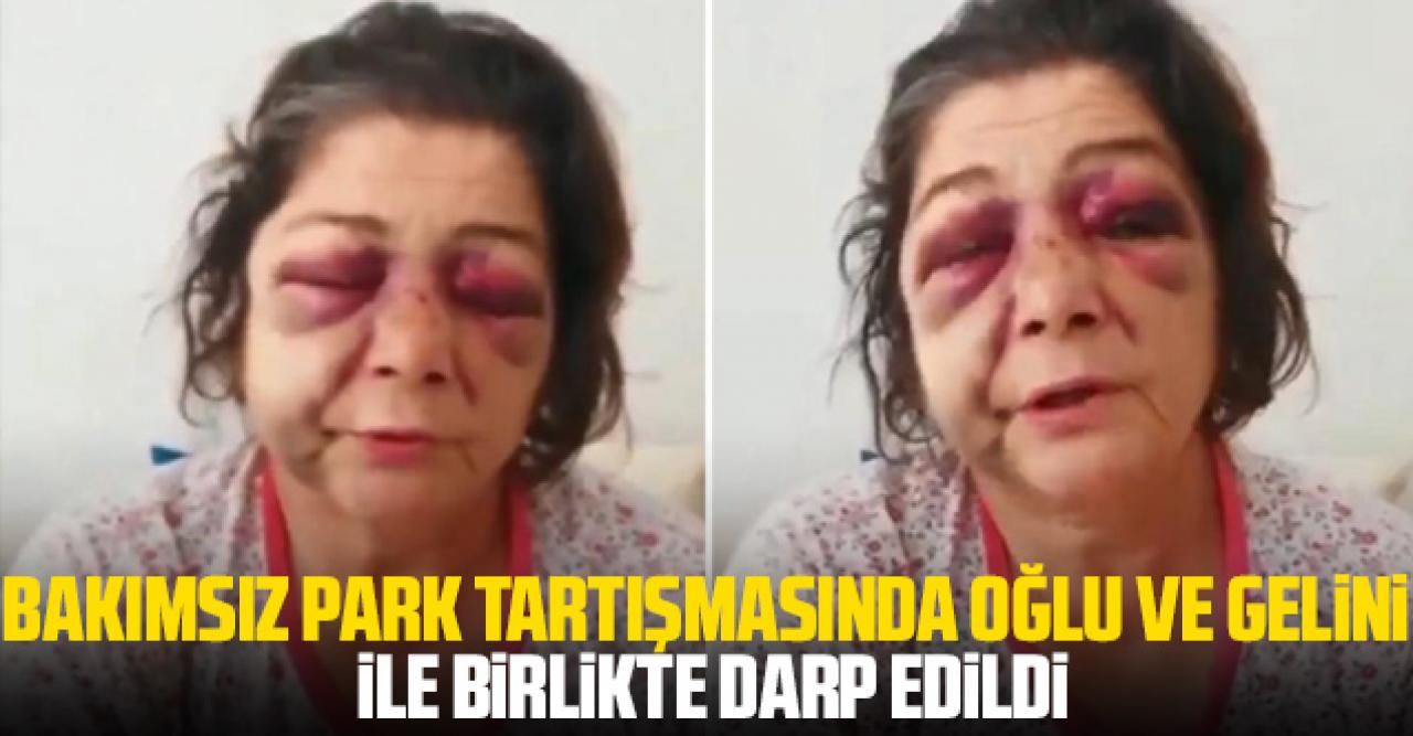 Belediye başkanının yanında oğlu ve gelini ile birlikte darbedildi