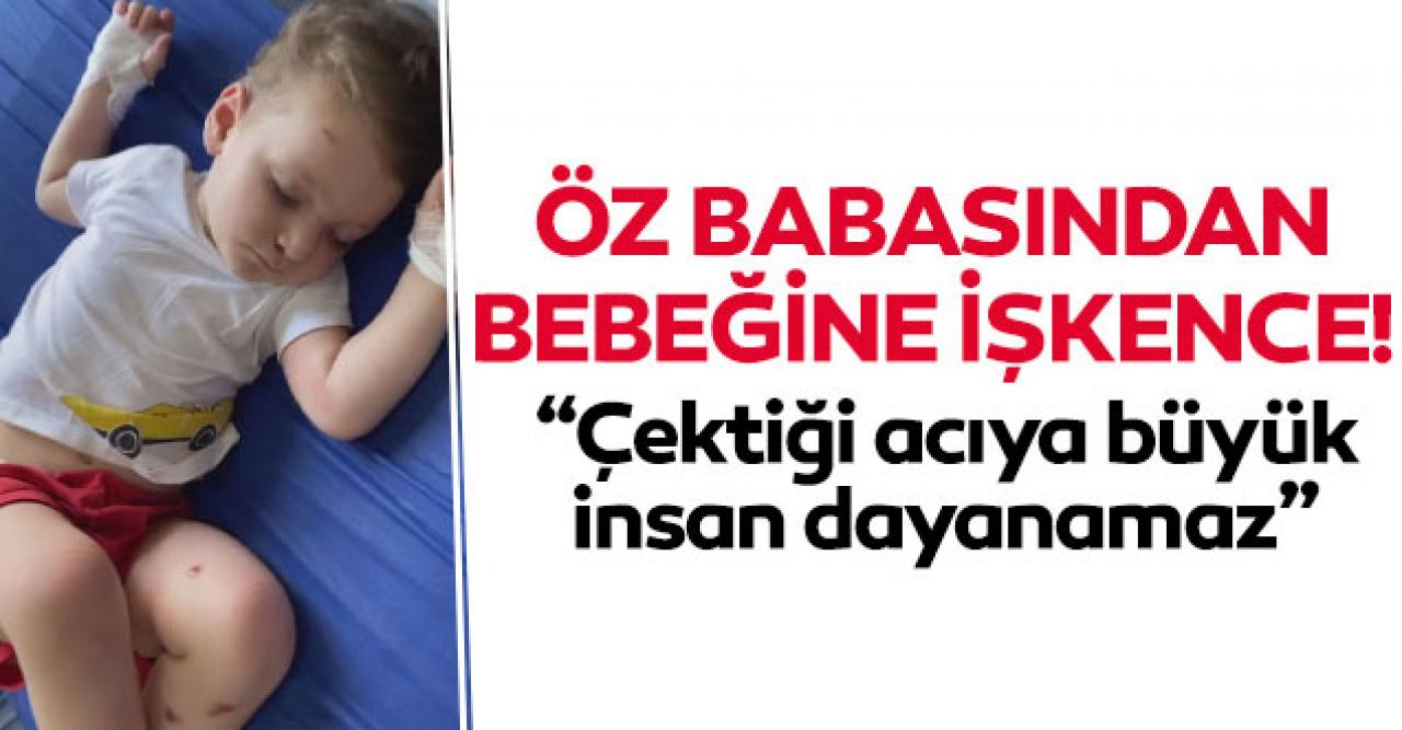 Öz babasından bebeğe işkence!