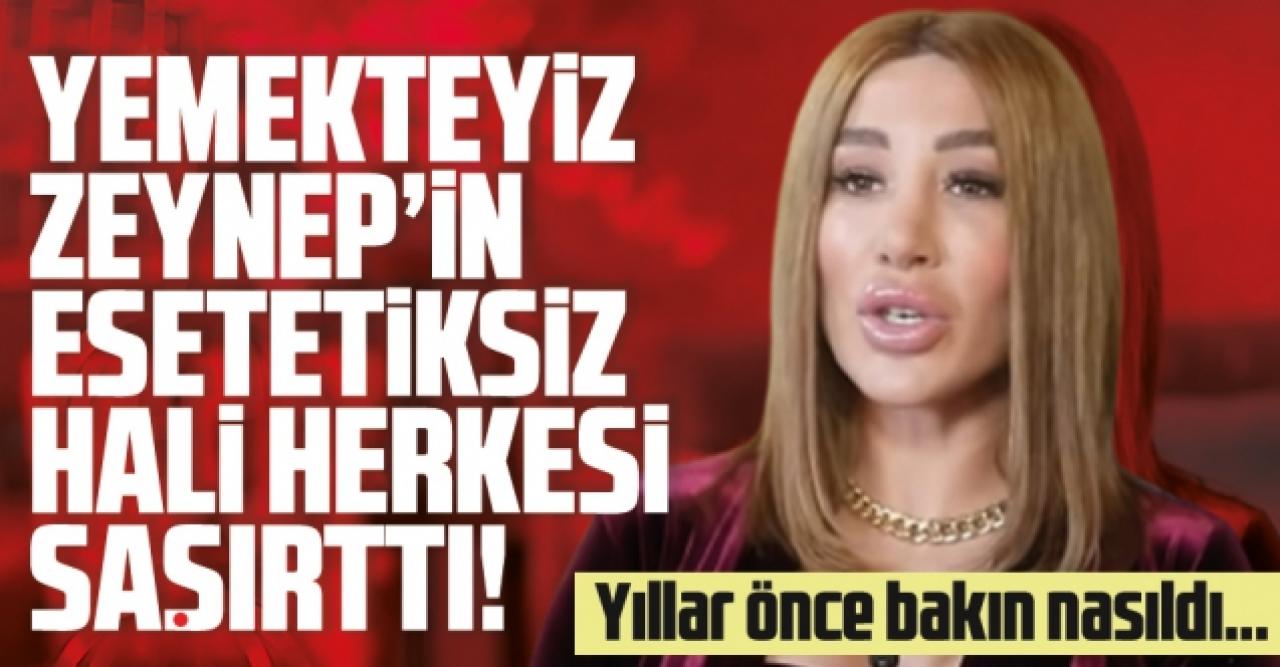 Zeynep Billur Uludağ'ın estetiksiz haline bakın! Yaşadığı değişim şoke etti