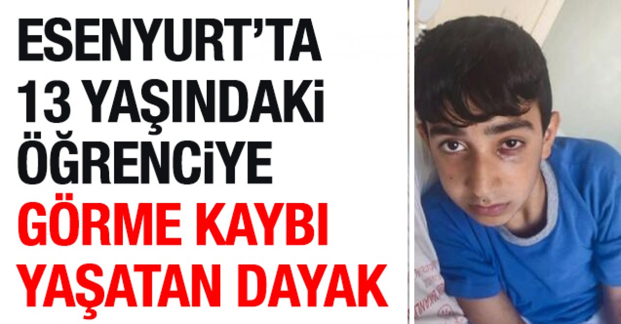 Ortaokulda görme kaybı yaşatan dayak