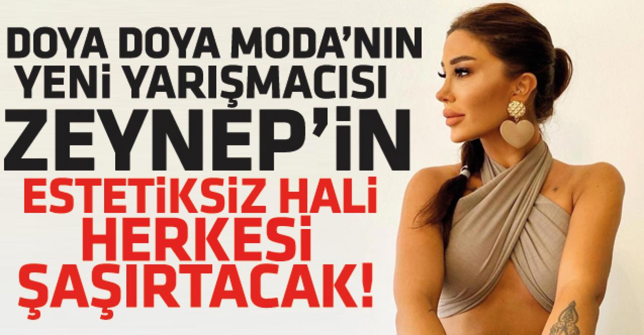 Doya Doya Moda Zeynep Billur Uludağ estetiksiz hali görünce inanamayacaksınız!