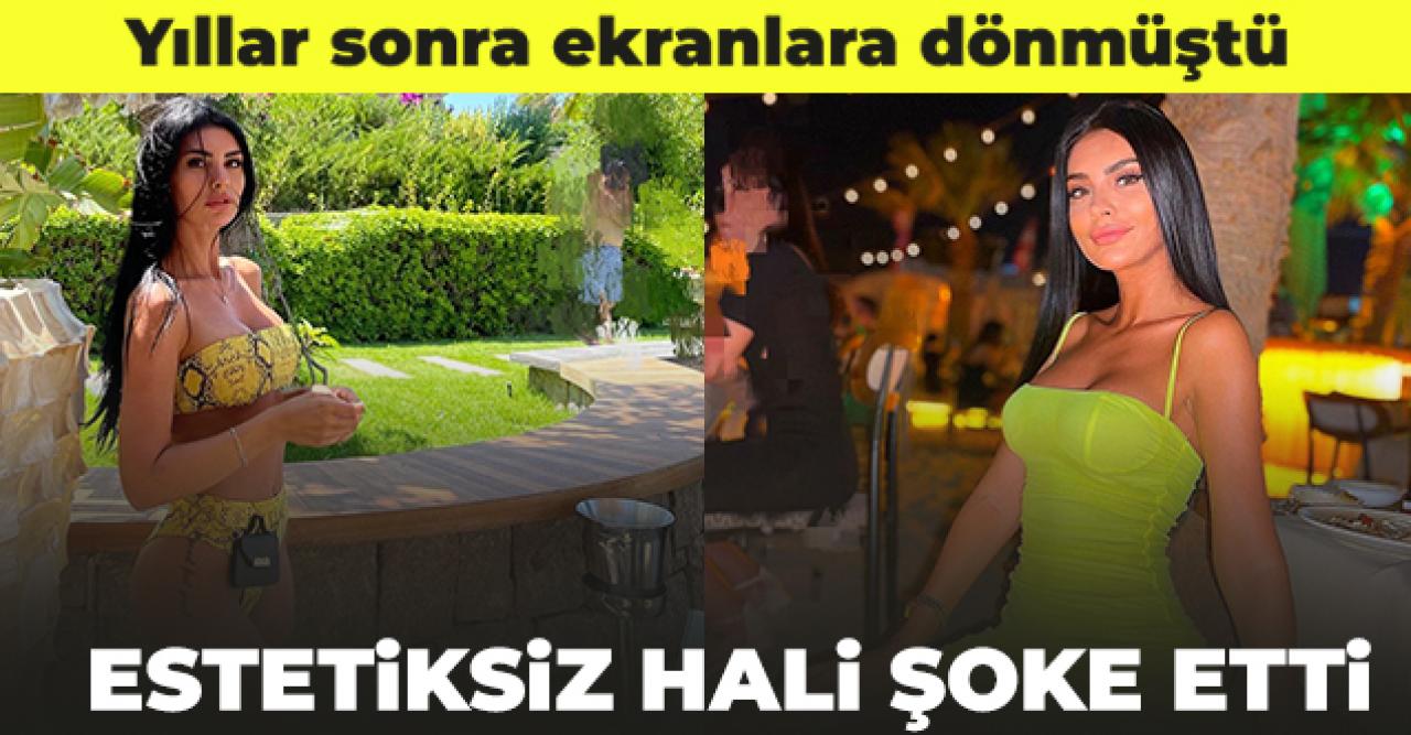 Doya Doya Moda Gamze Taşkın estetiksiz hali ile şaşırttı