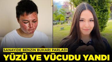 Sanayide benzin buharı parladı: Yüzü ve vücudu yandı