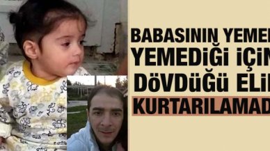 Babasının yemek yemediği için dövdüğü Elif Hazal Yılmaz, kurtarılamadı