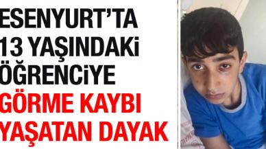 Ortaokulda görme kaybı yaşatan dayak