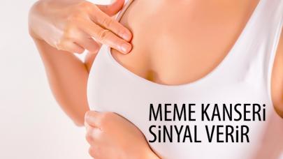 Meme kanseri sinyal verir