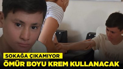 Gündüzleri evden çıkamıyor: 'İlaçları kullanmadan uyuyamıyorum'