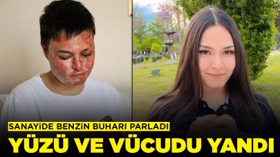 Sanayide benzin buharı parladı: Yüzü ve vücudu yandı