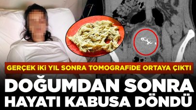 Doğumdan sonra hayatı kabusa döndü: Gerçek iki yıl sonra fark edildi