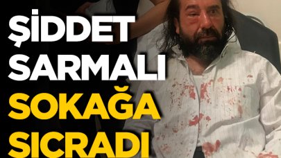 Şiddet sarmalı sokağa sıçradı!