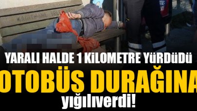 Yaralı bacakla 1 kilometre yürüyüp durağa yığıldı!