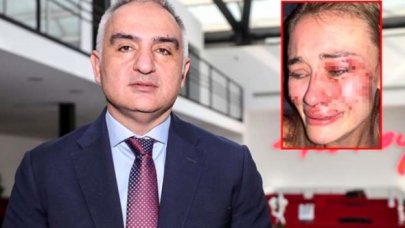 Bakan Ersoy'dan Daria Kyryliuk'un Çeşme'de darp edilmesine tepki geldi