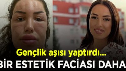 Estetik facialarına bir yenisi daha eklendi!  Gençlik aşısı yaptırmak isteyen kadın tanınmaz halde