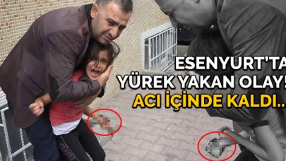 Esenyurt'ta acı olay! Demir kapı parmaklıkları bileğine saplandı