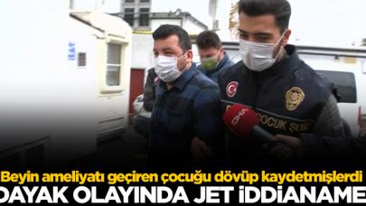 Çocuğa dayak olayında jet iddianame