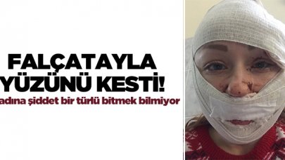 Falçatayla yüzünü kesti!