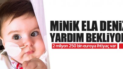 SMA hastası minik Ela Deniz yardım eli bekliyor!