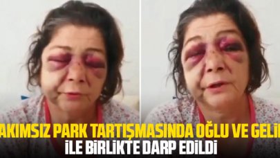 Belediye başkanının yanında oğlu ve gelini ile birlikte darbedildi