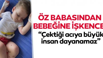 Öz babasından bebeğe işkence!