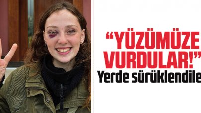 Yüzümüze vurdular