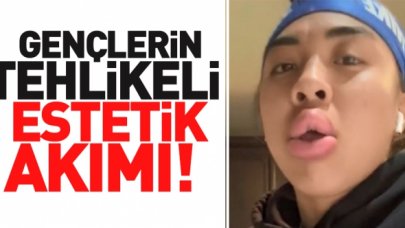 Gençlerin çok tehlikeli estetik akımı! Günden güne artıyor