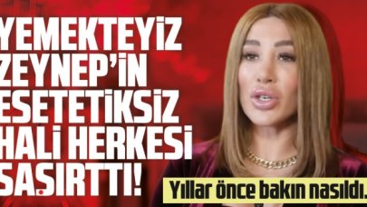 Zeynep Billur Uludağ'ın estetiksiz haline bakın! Yaşadığı değişim şoke etti