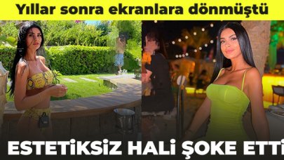 Doya Doya Moda Gamze Taşkın estetiksiz hali ile şaşırttı