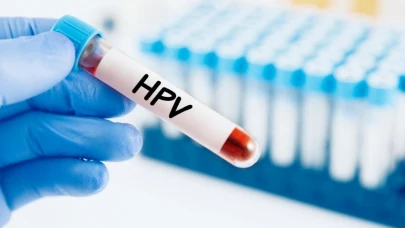 HPV Nedir? HPV Belirtileri Nelerdir, Nasıl Bulaşır?