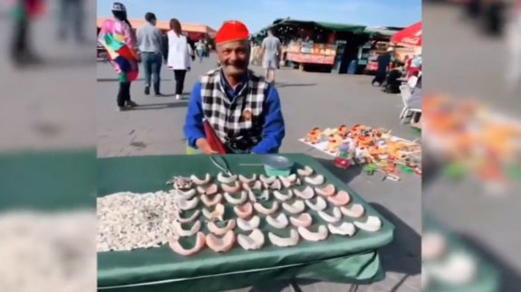 Diş tedavisi fiyatları tavan yapınca takma dişler pazar tezgahlarına düştü!